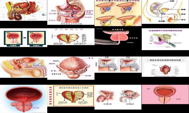 汕头前列腺