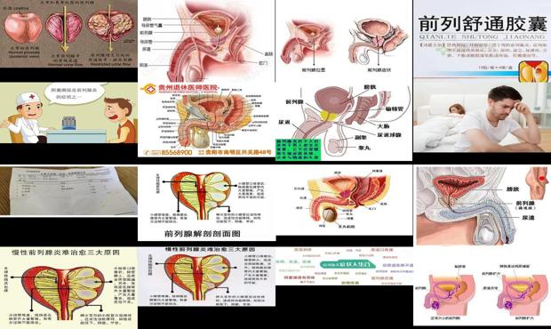 汕头前列腺炎