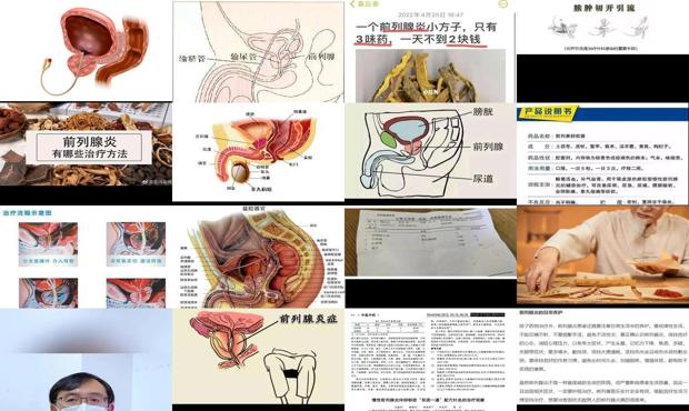 汕头前列腺炎如何治疗