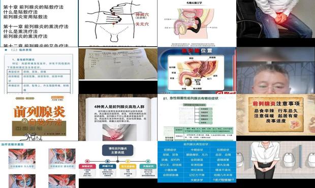 汕头前列腺炎症状自我疗法