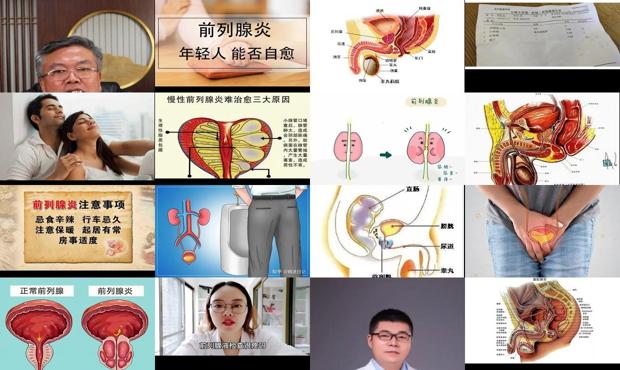 汕头前列腺炎会自愈吗