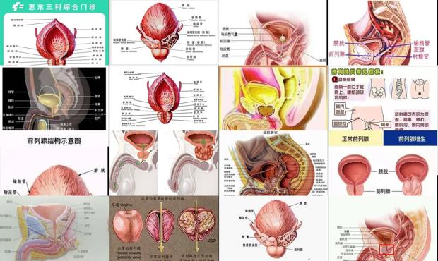 汕头前列腺是什么