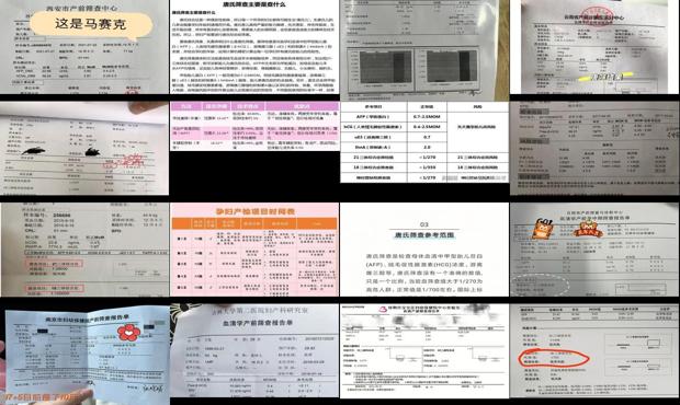 汕头唐筛主要检查哪三项