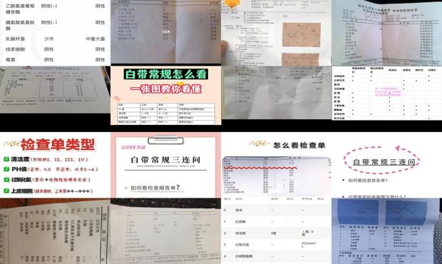 汕头白带常规怎么检查