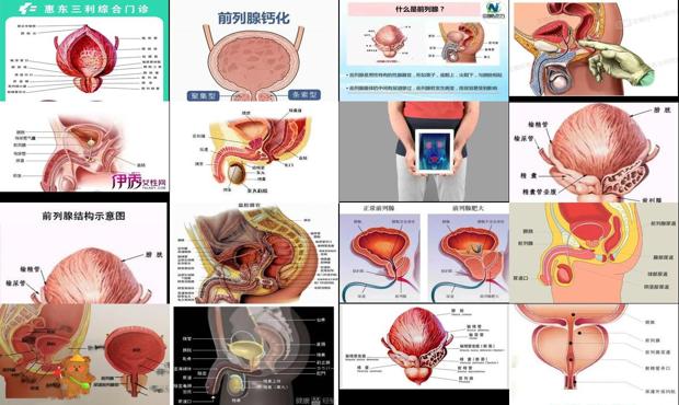 汕头什么是前列腺