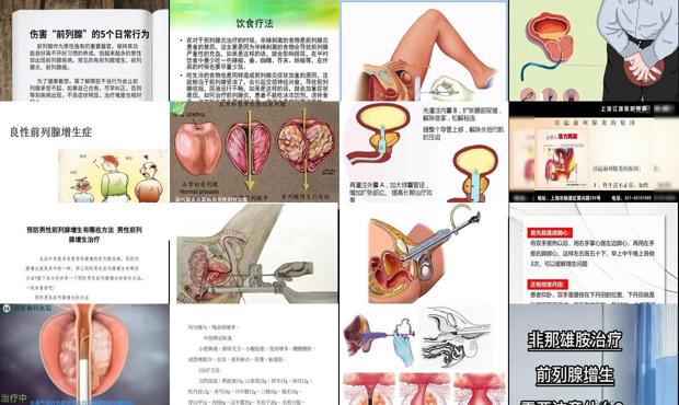 汕头前列腺增生的治疗方法