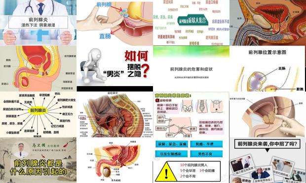 汕头前列腺炎是什么引起的