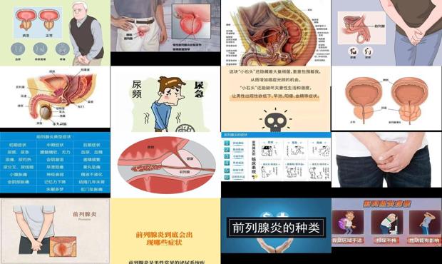 汕头男性前列腺的症状有哪些