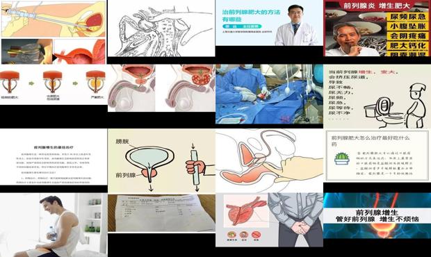 汕头前列腺肥大怎么治疗*好的方法