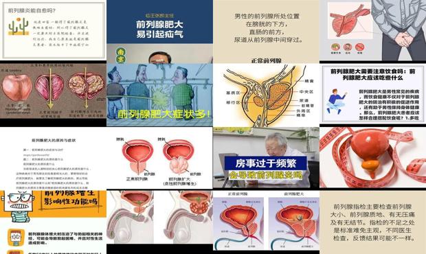 汕头前列腺肥大能自愈吗