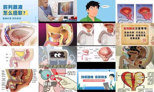汕头前列腺怎么办