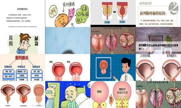 汕头前列腺肥大的原因