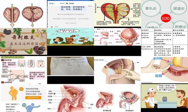 汕头前列腺炎是怎样造成的