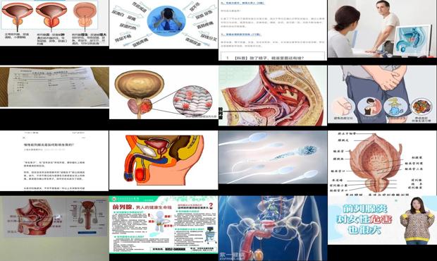 汕头前列腺会导致不孕吗