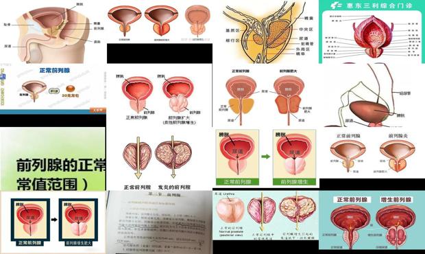 汕头正常的前列腺是多大