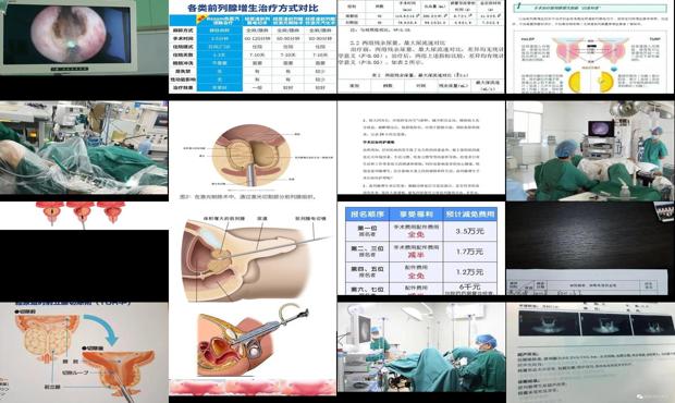 汕头前列腺增生手术费