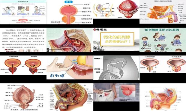 汕头什么叫前列腺