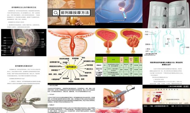 汕头前列腺 治疗 方法比较