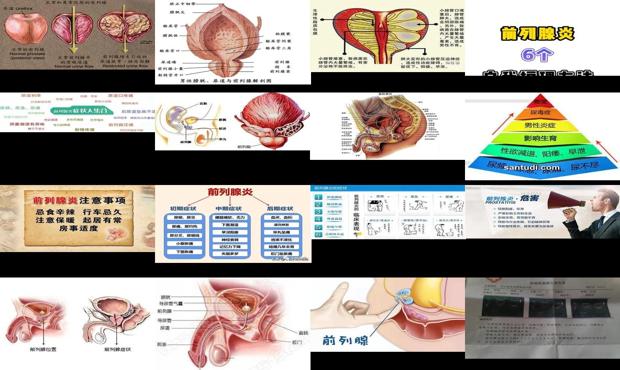 汕头前列腺炎是什么病状