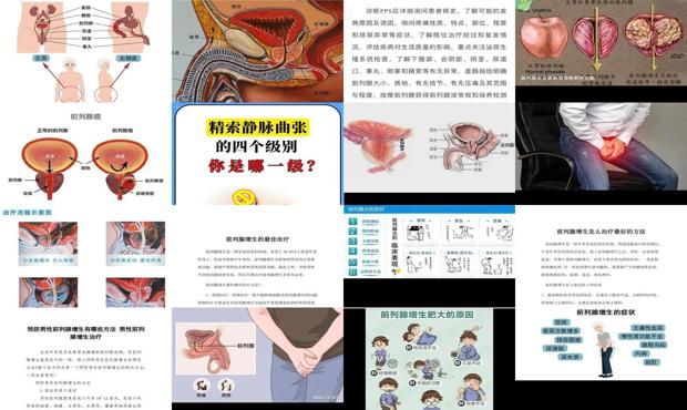 汕头前列腺症状与治疗方法