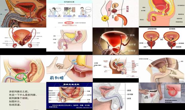 汕头前列腺是哪里