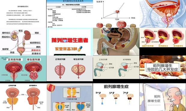 汕头前列腺增生的原因