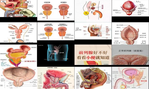 汕头男性前列腺