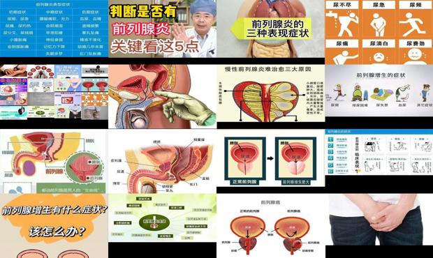 汕头前列腺有些什么症状