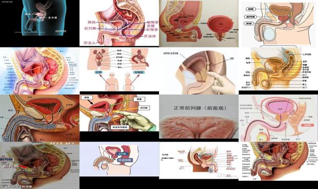 汕头前列腺在哪里位置图片