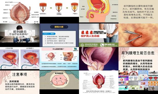 汕头男性前列腺能自愈吗