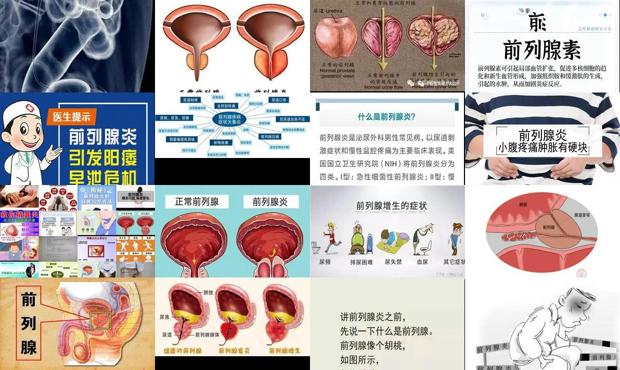 汕头什么是前列腺炎症