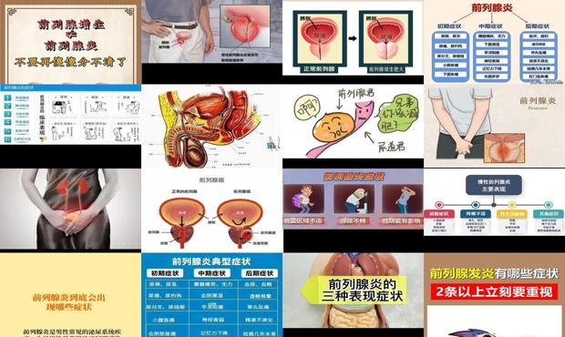 汕头前列腺炎症状有哪些