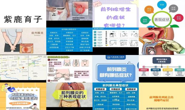 汕头前列腺有哪些症状?