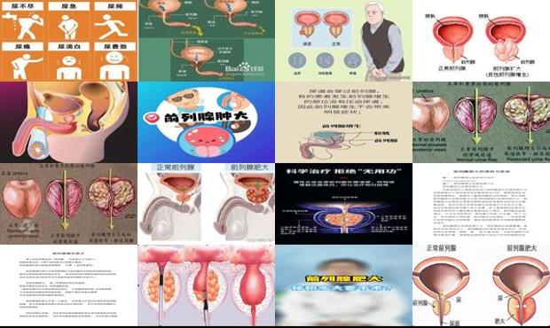 汕头前列腺肥大是咋回事