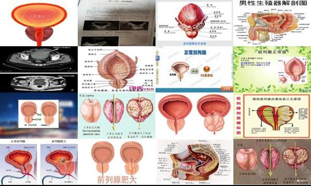 汕头前列腺多大属于正常