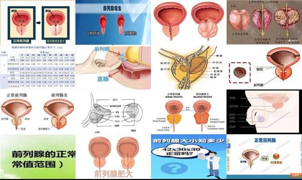 汕头正常前列腺的大小是多少正常