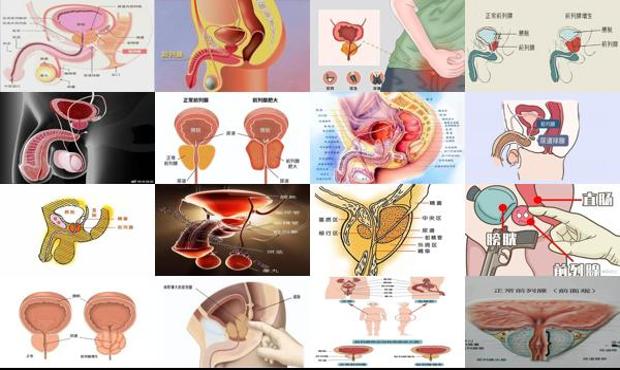 汕头前列腺在人体的位置图