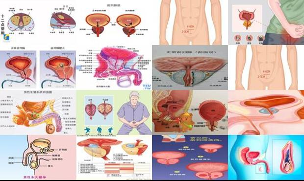 汕头前列腺是哪个部位
