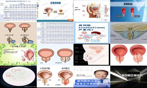 汕头前列腺大小多少是正常