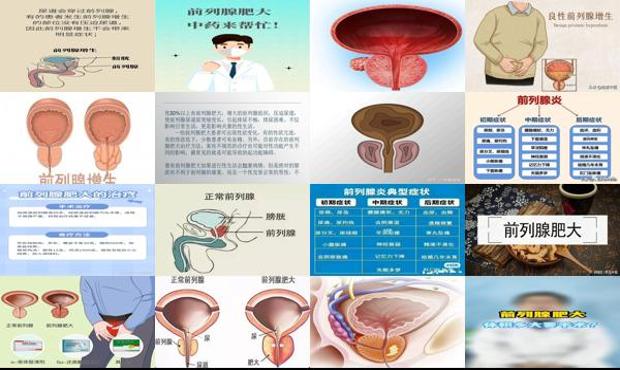 汕头前列腺肥大是什么症状